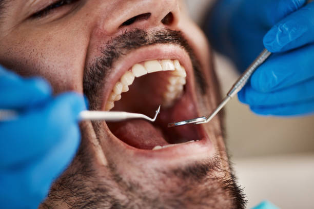 Best Weekend Emergency Dentist in Mexico, IN
